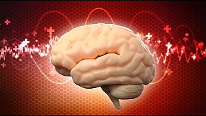 Felç, ölüm nedenleri arasında üçüncü sırada