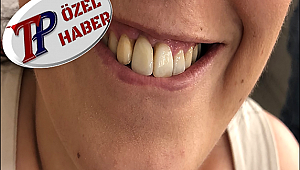 4 Bin 450 TL verdim, dişimi yamuk yaptılar