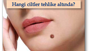 Benler şekil ve renk değiştiriyorsa dikkat