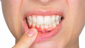 En sevdiğiniz içecekler dişlerinize zarar veriyor!