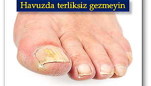 Sık havuz kullanımı ayak ve tırnak mantarı riskini 20 kat artırıyor