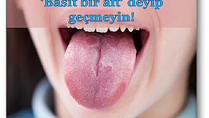 Dil kanserinin 5 önemli belirtisi