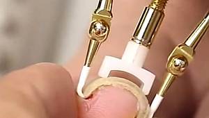 Can sıkan rahatsızlık: Tırnak batması