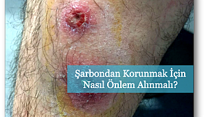 Şarbon hakkında bilmediklerimiz