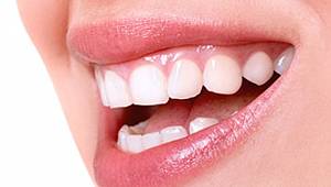 Bunu bilmeli: Sağlıklı diş eti gülkurusu rengindedir