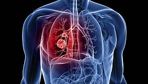 Tüketiciler sağlık önemli: Akciğer sağlığı için 6 öneri