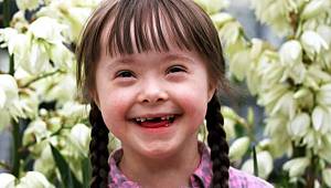 Dünya Down Sendromu Farkındalık Günü