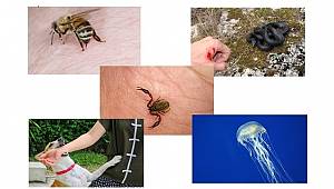 Arı – akrep – yılan sokmasında ne yapılmalı?